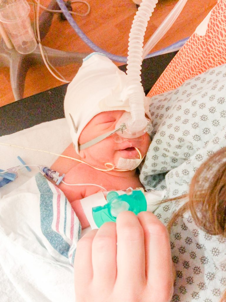 Baby smiling in NICU with cpap on 